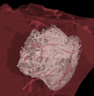 Imaged Os cordis within the chimpanzee heart 